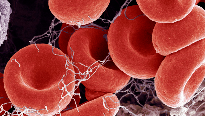 Blood-Clots_Feature-Image