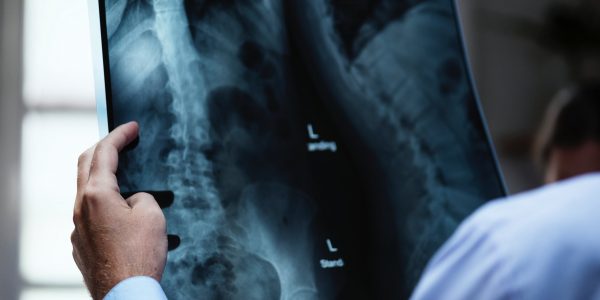 Osteoarthritis-2.0-1